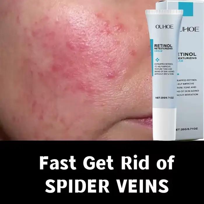 Crème réparatrice pour les rougeurs du visage, améliore la sécheresse de la peau sensible, hydratant