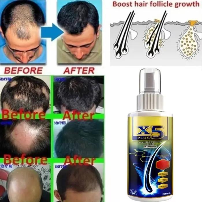 Huile essentielle naturelle anti-chute de cheveux pour femme, traitement capillaire, croissance rapi