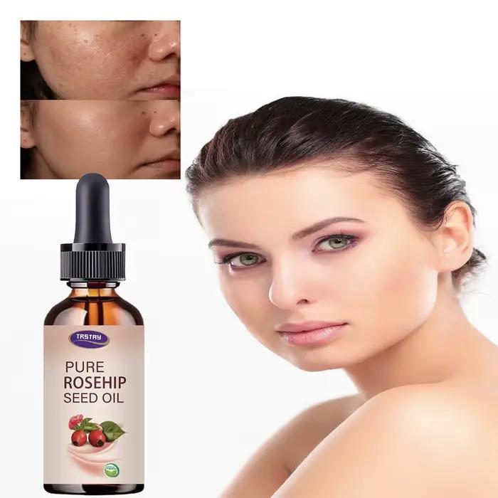 5ML/15ML/30ML/50ML/óleo de semente de rosa mosqueta pura reparação huile de essência hydratant