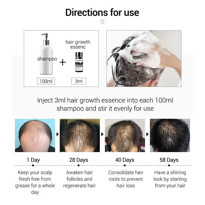 LANBENA huile essentielle nourrissante pour cheveux traitement Anti-perte