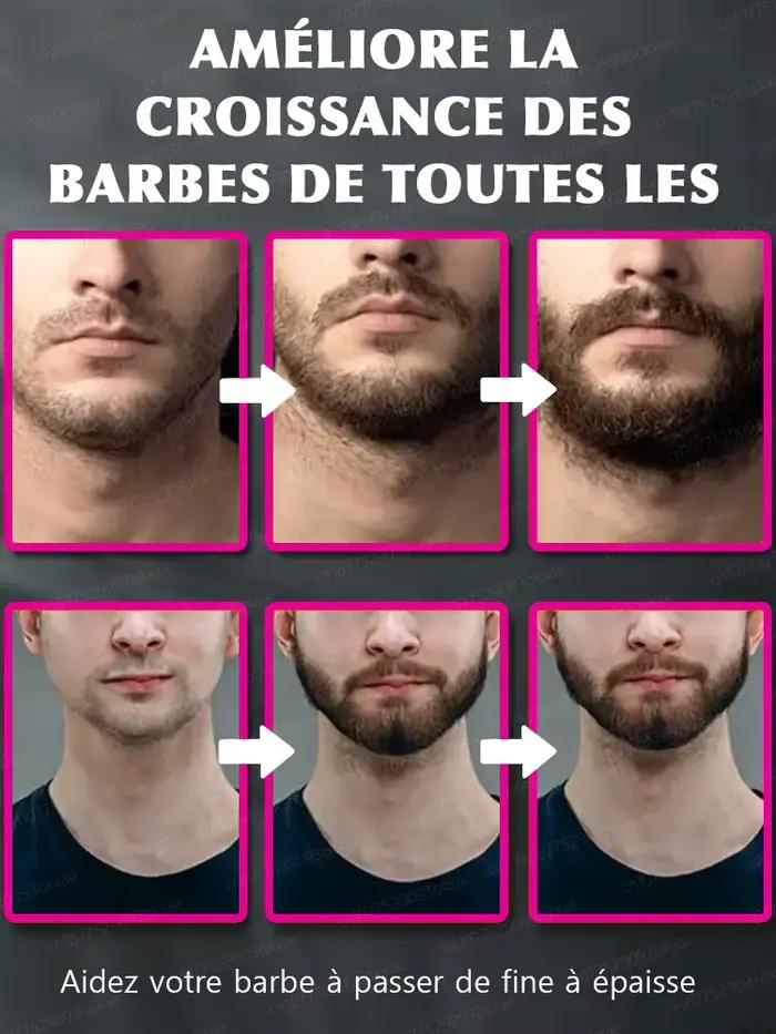 Essence de croissance de la barbe. Elle aide votre