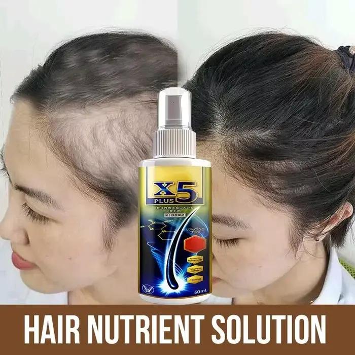Huile essentielle naturelle anti-chute de cheveux pour femme