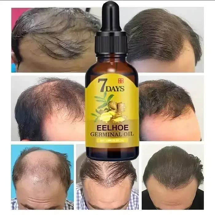 Sérum de croissance des cheveux