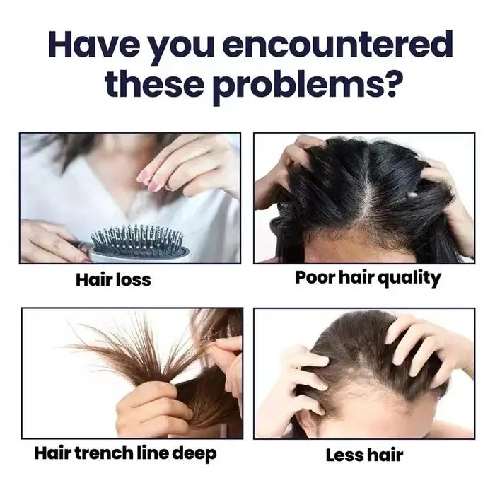 Traitement Essentiel de Repousse et de Croissance des Cheveux