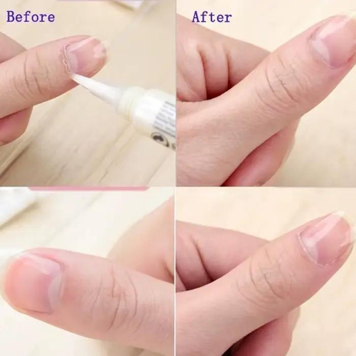1 stylo huile pour cuticules, huile nutritive pour ongles, traitement des cuticules, revitalisant pour cuticules, prévention des ongles abîmés, nourrissant pour la peau
