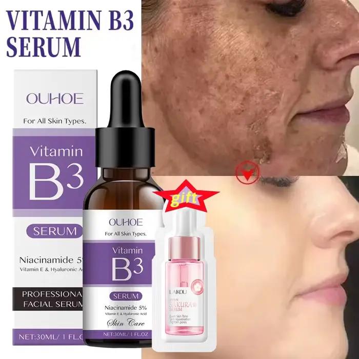 Sérum à la vitamine B3 pour estomper les taches brunes