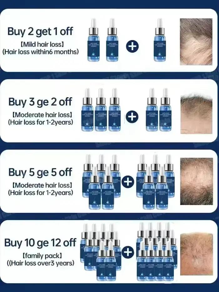 2 Sérum de croissance des cheveux et anti-chute de cheveux