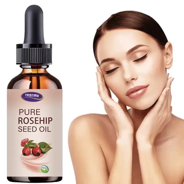 5ML/15ML/30ML/50ML/óleo de semente de rosa mosqueta pura reparação huile de essência hydratant