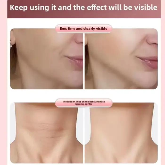 Rouleau de massage facial en V pour raffermir et affiner le visage – Outil de beauté
